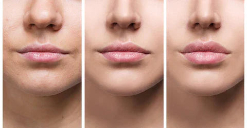 Velara Instant Lip Plumper Serum For Fuller Lips Indoors