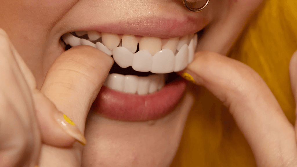 NovaBright Snap-On Veneers, Instant Smile Cover For Upper Or Lower Teeth