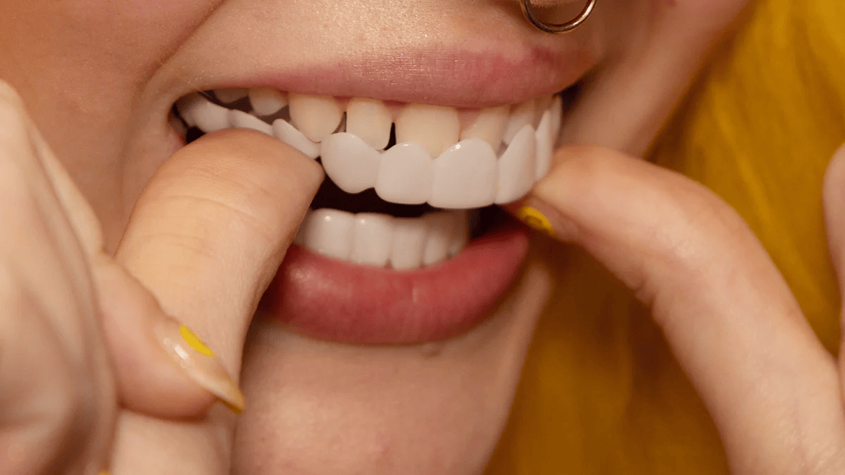 NovaBright Snap-On Veneers, Instant Smile Cover For Upper Or Lower Teeth