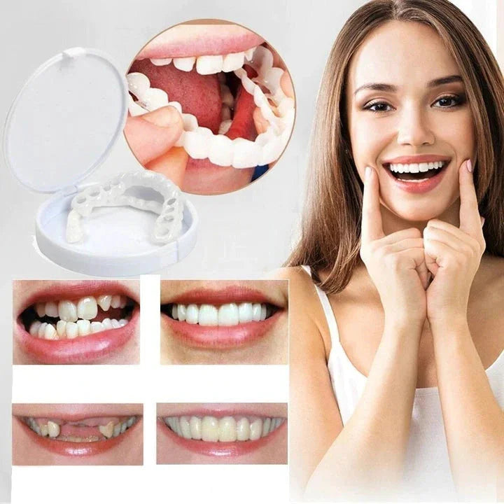 NovaBright Snap-On Veneers, Instant Smile Cover For Upper Or Lower Teeth