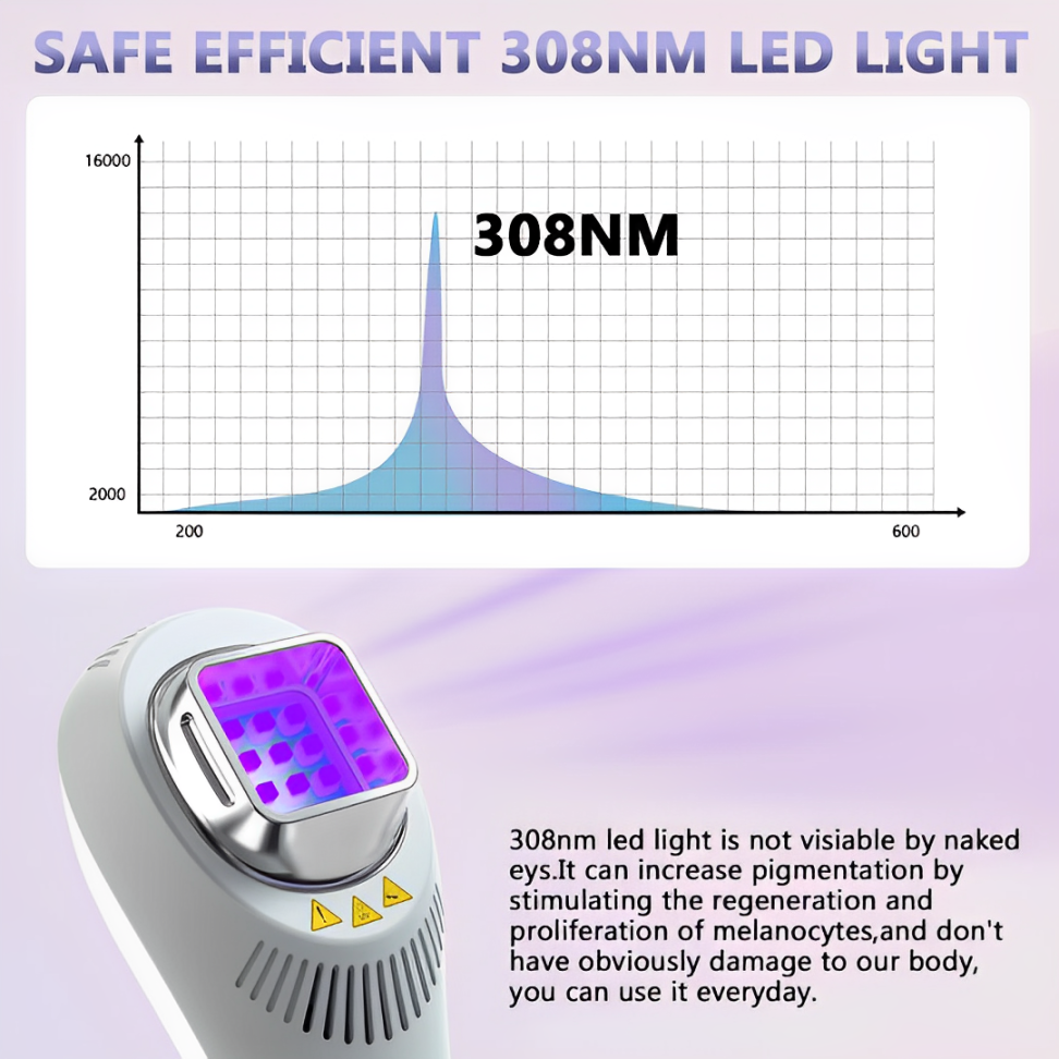 VitaLuma 308nm UVB Home Light Lamp For Pigment Balance