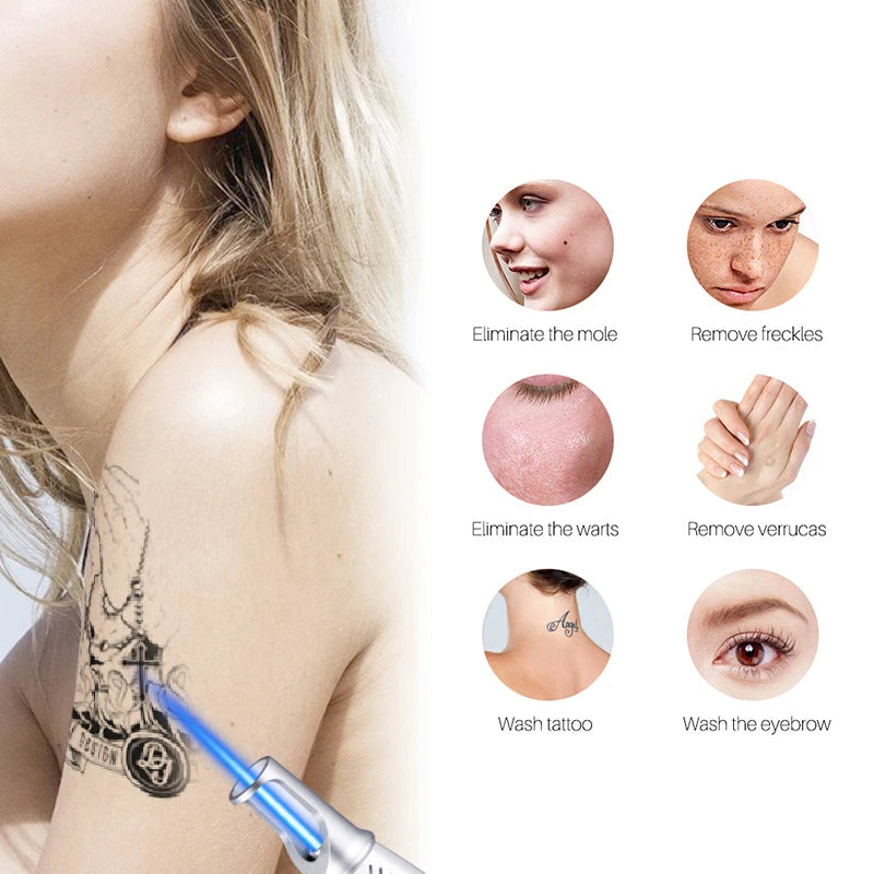 LumiDerm At-Home Laser Pen For Tattoos And Skin Spots