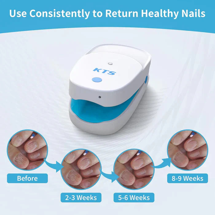 Dispositivo de luz para el cuidado de uñas con clip, doble haz de 905 nm y 470 nm, recargable