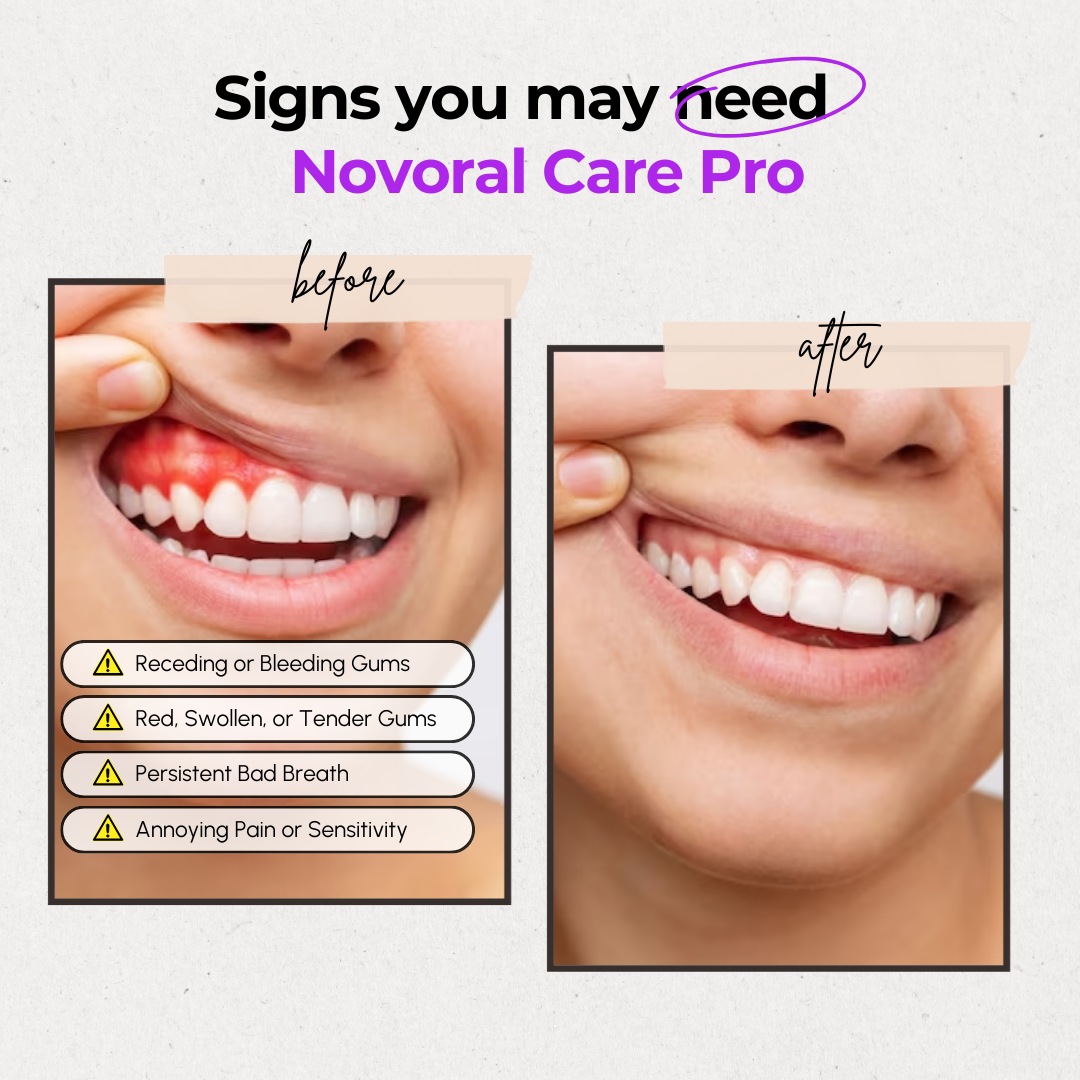 LumaGum Pro Gum Therapy LED For Healthier Gums At Home