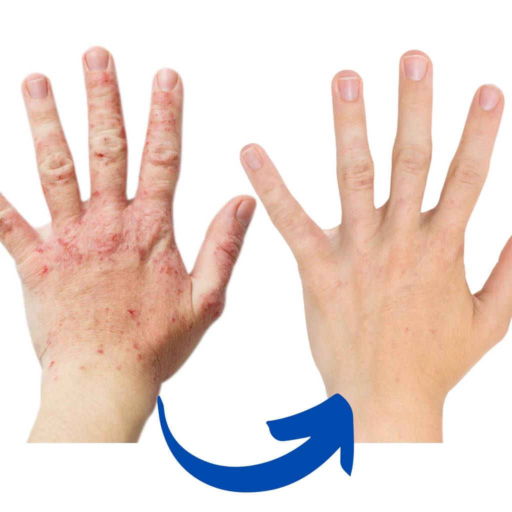 Infračervené terapeutické rukavice ArthroGlow na úlevu od bolesti rukou