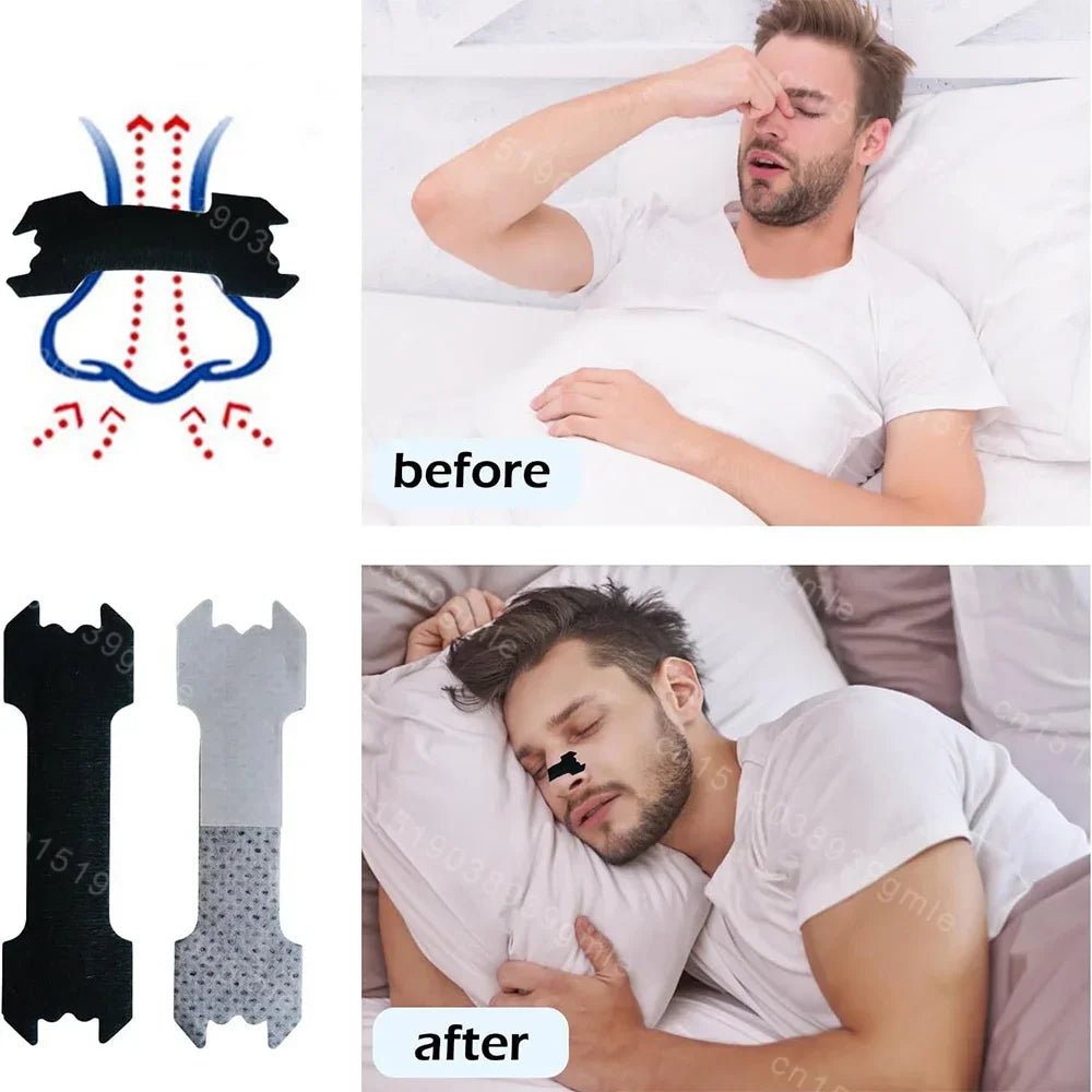 Bandes nasales anti-ronflement pour une respiration libre et un meilleur sommeil - Fioriscas