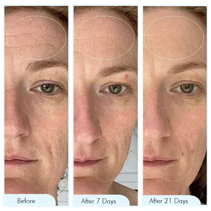 Bio-Collagen Hydrating Sheet Mask By Aurelia Glow For Glowing Skin