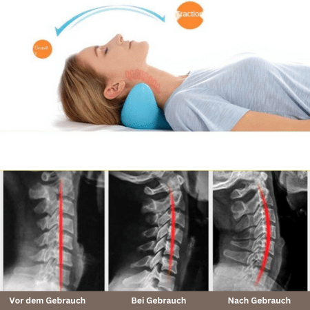 Almohada ergonómica para masaje de cuello para relajación y alivio del dolor - Fioriscas