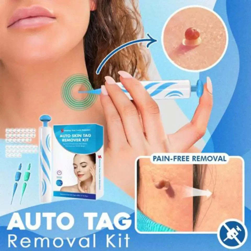LumaDerm Skin Tag Removal Kit With A Targeted Applicator At Home Use