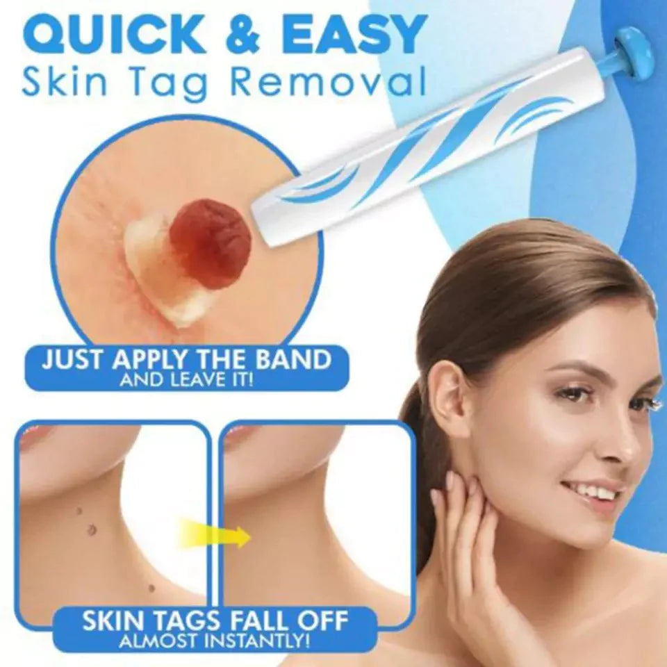 LumaDerm Skin Tag Removal Kit With A Targeted Applicator At Home Use