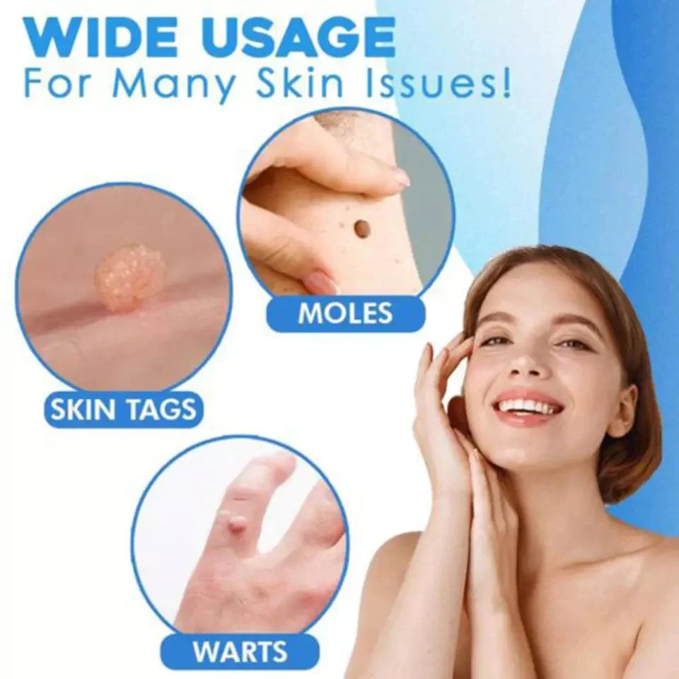 LumaDerm Skin Tag Removal Kit With A Targeted Applicator At Home Use