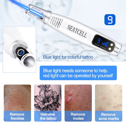 LumiDerm At-Home Laser Pen For Tattoos And Skin Spots