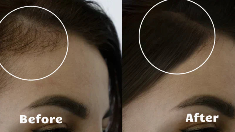 AstraGlow Hair Light Therapy For Thicker Fuller Locks