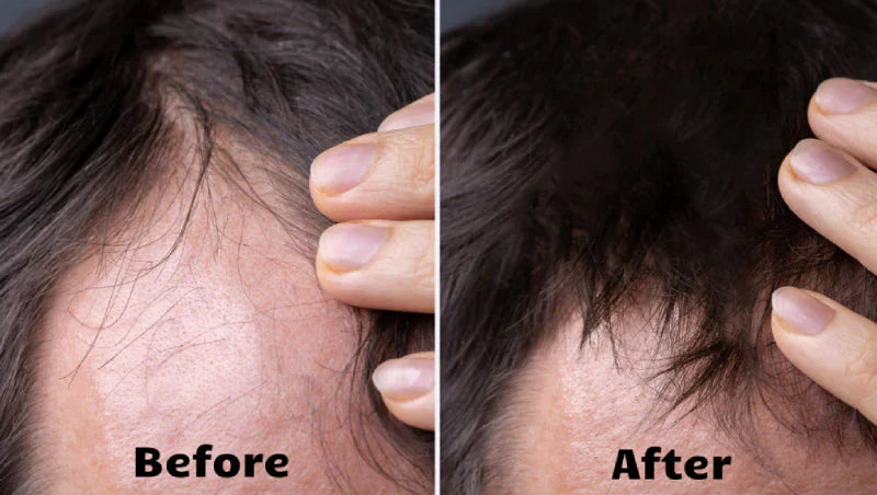 AstraGlow Hair Light Therapy For Thicker Fuller Locks