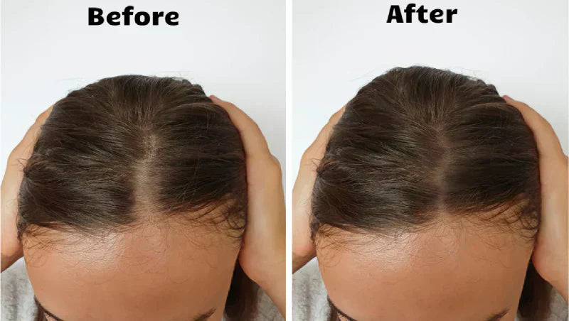 AstraGlow Hair Light Therapy For Thicker Fuller Locks