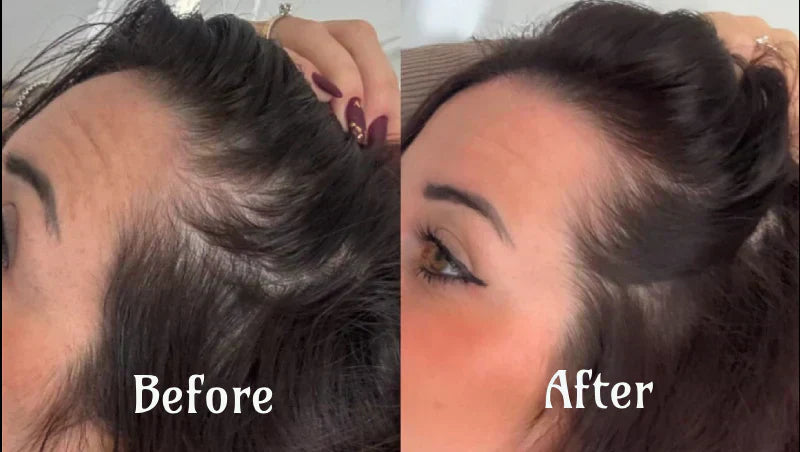 AstraGlow Hair Light Therapy For Thicker Fuller Locks