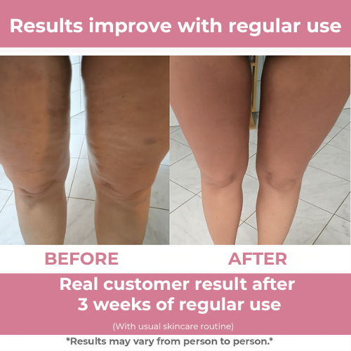 FirmFlex Pro Triple Action Tightening Roller For Smoothing Skin