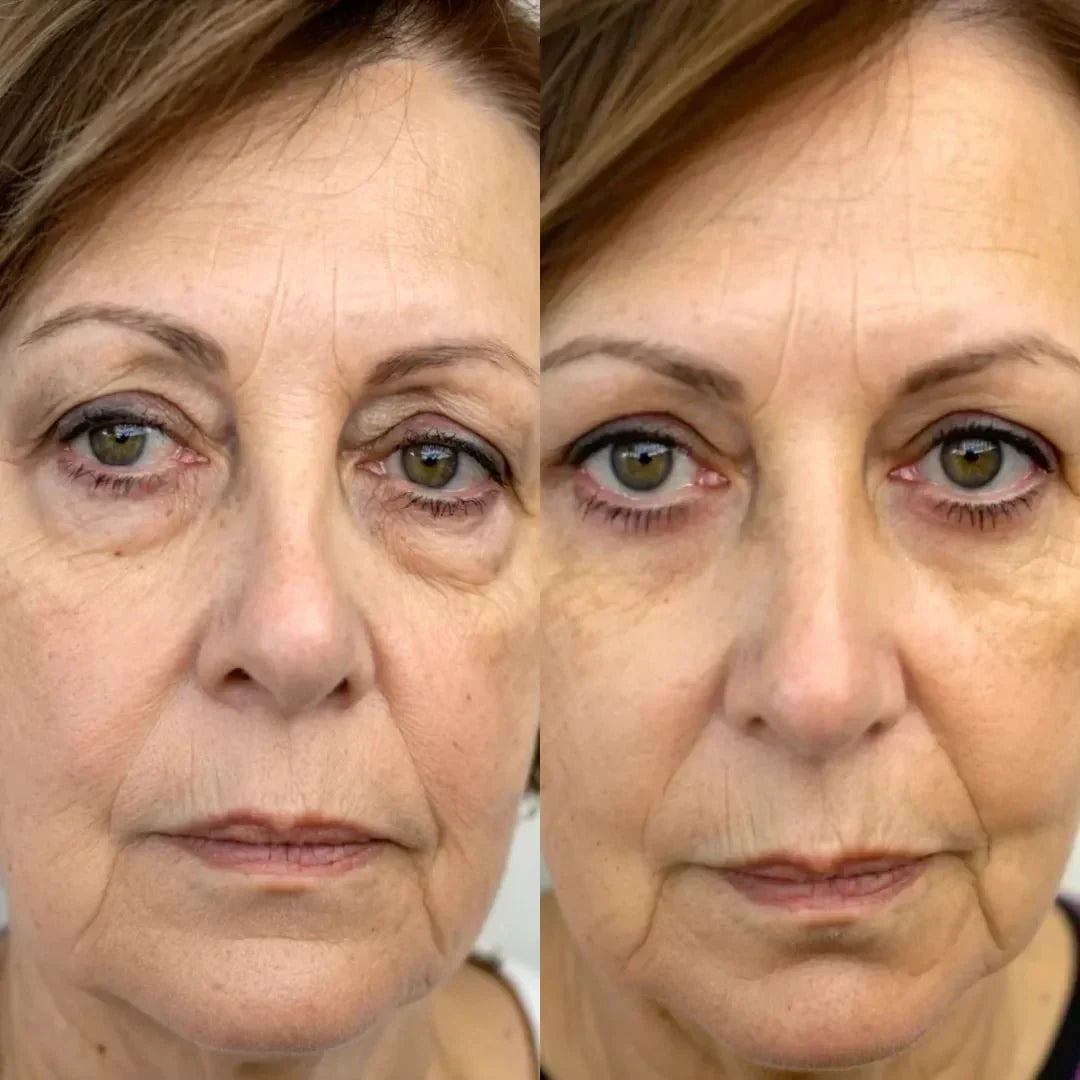 LumaNova Eye Rejuvenator – mikroproudové ošetření a terapie červeným světlem