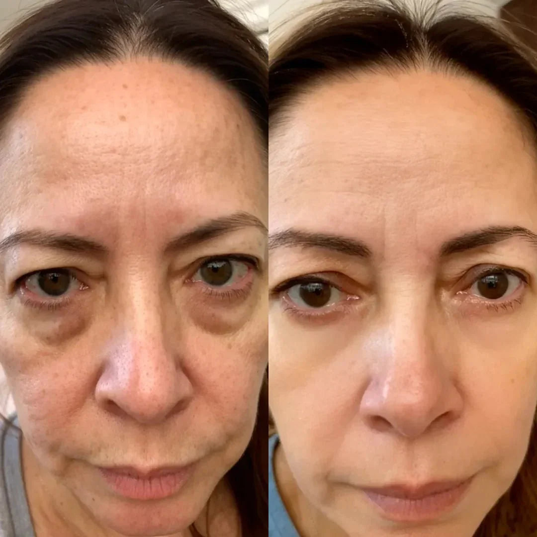 LumaNova Eye Rejuvenator – mikroproudové ošetření a terapie červeným světlem
