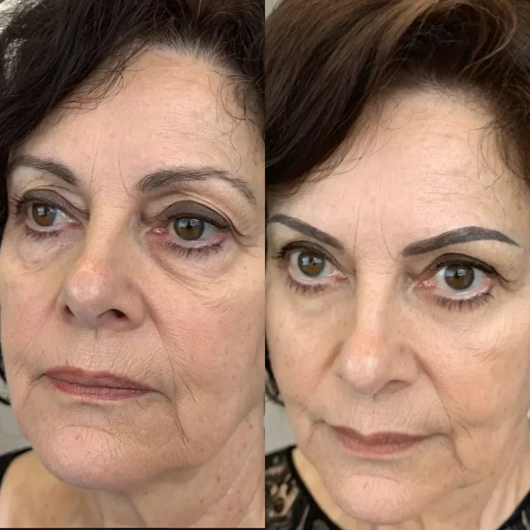 LumaNova Eye Rejuvenator – mikroproudové ošetření a terapie červeným světlem