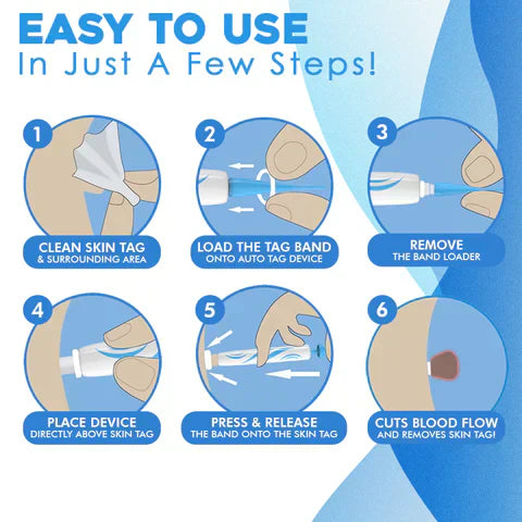 LumaDerm Skin Tag Removal Kit With A Targeted Applicator At Home Use