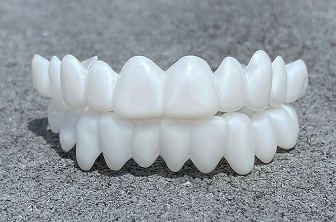 Tandprothese met witte tandlenzen - Fioriscas