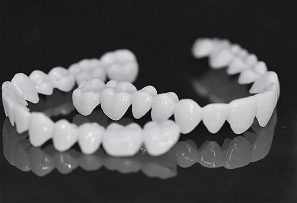 Tandprothese met witte tandlenzen - Fioriscas