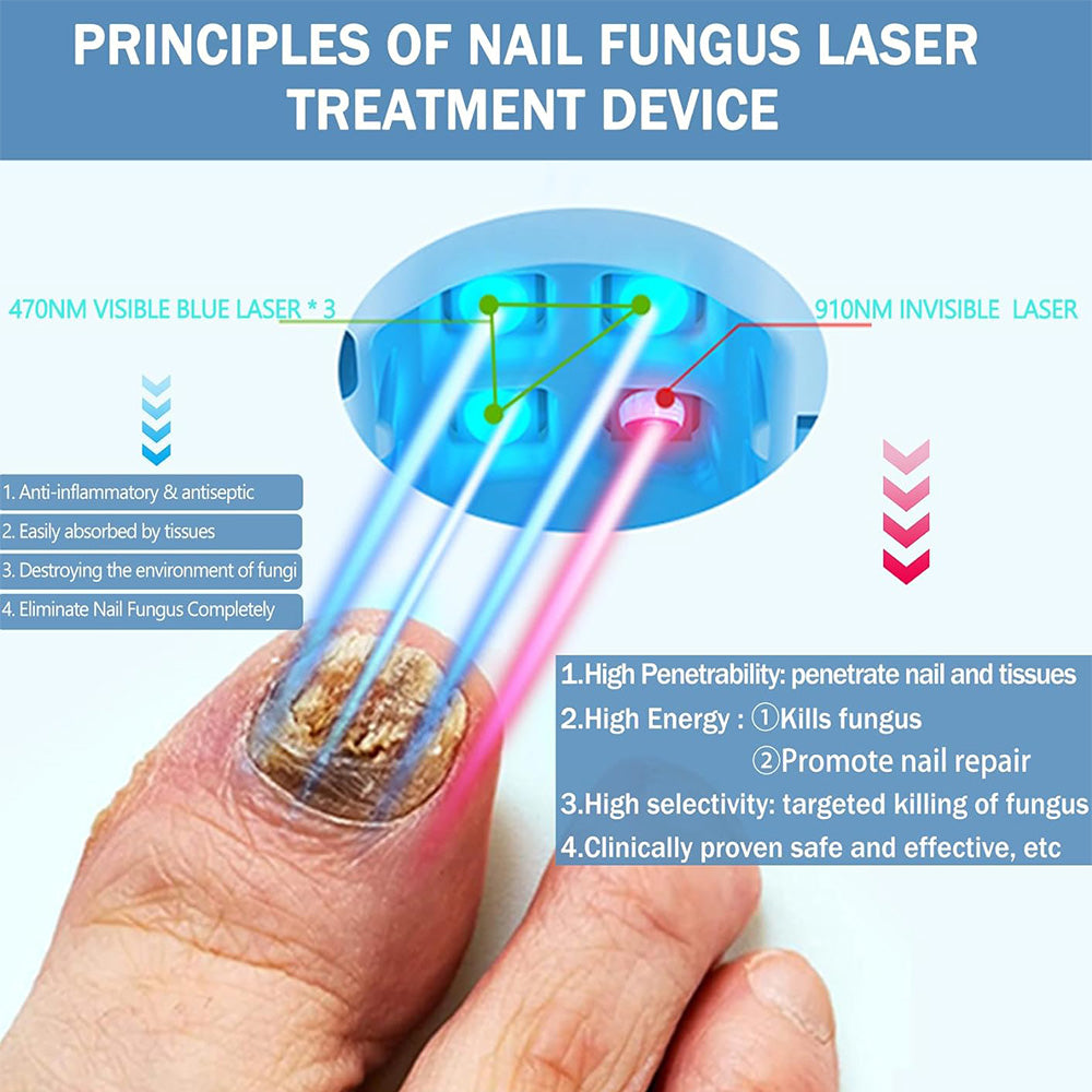 NexaLume Home Laser Nail Tool For Easy Use And At Home Care
