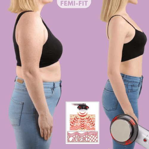 3-in-1 Cellulite and Fat Burner with EMS, Ultrasound & Infrared - Fioriscas