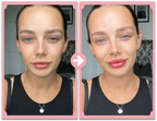 Poutify Lip Plumping Booster Kit Plus Edition For Fuller Lips