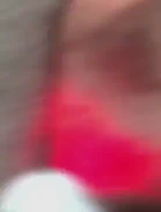 Bezdrátový laserový přístroj LumaPulse pro rychlou úlevu od bolesti