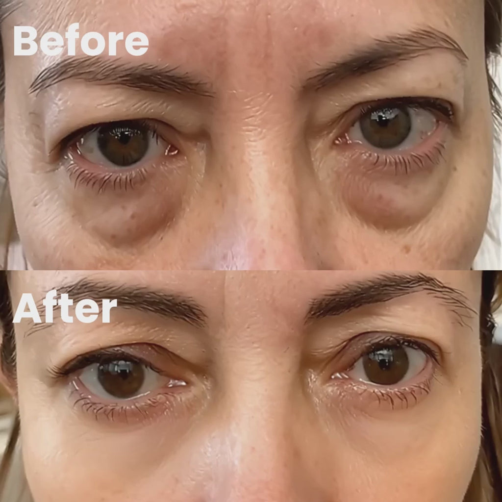 LumaNova Eye Rejuvenator – mikroproudové ošetření a terapie červeným světlem