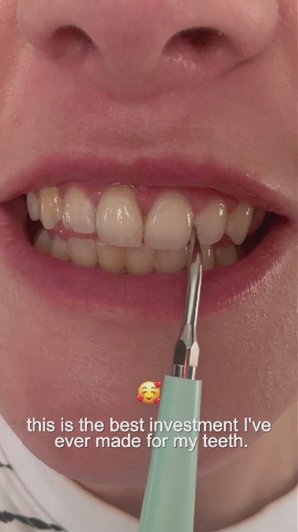 Ultrasonic Tooth Cleaner With Adjustable Sonic Vibration Settings