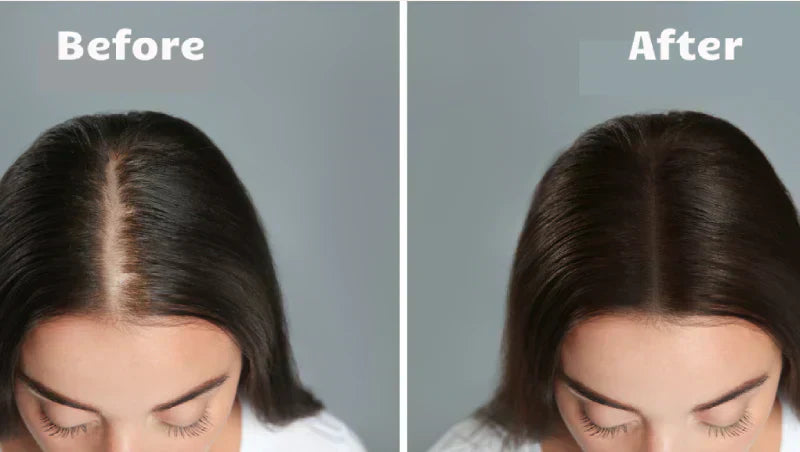 AstraGlow Hair Light Therapy For Thicker Fuller Locks