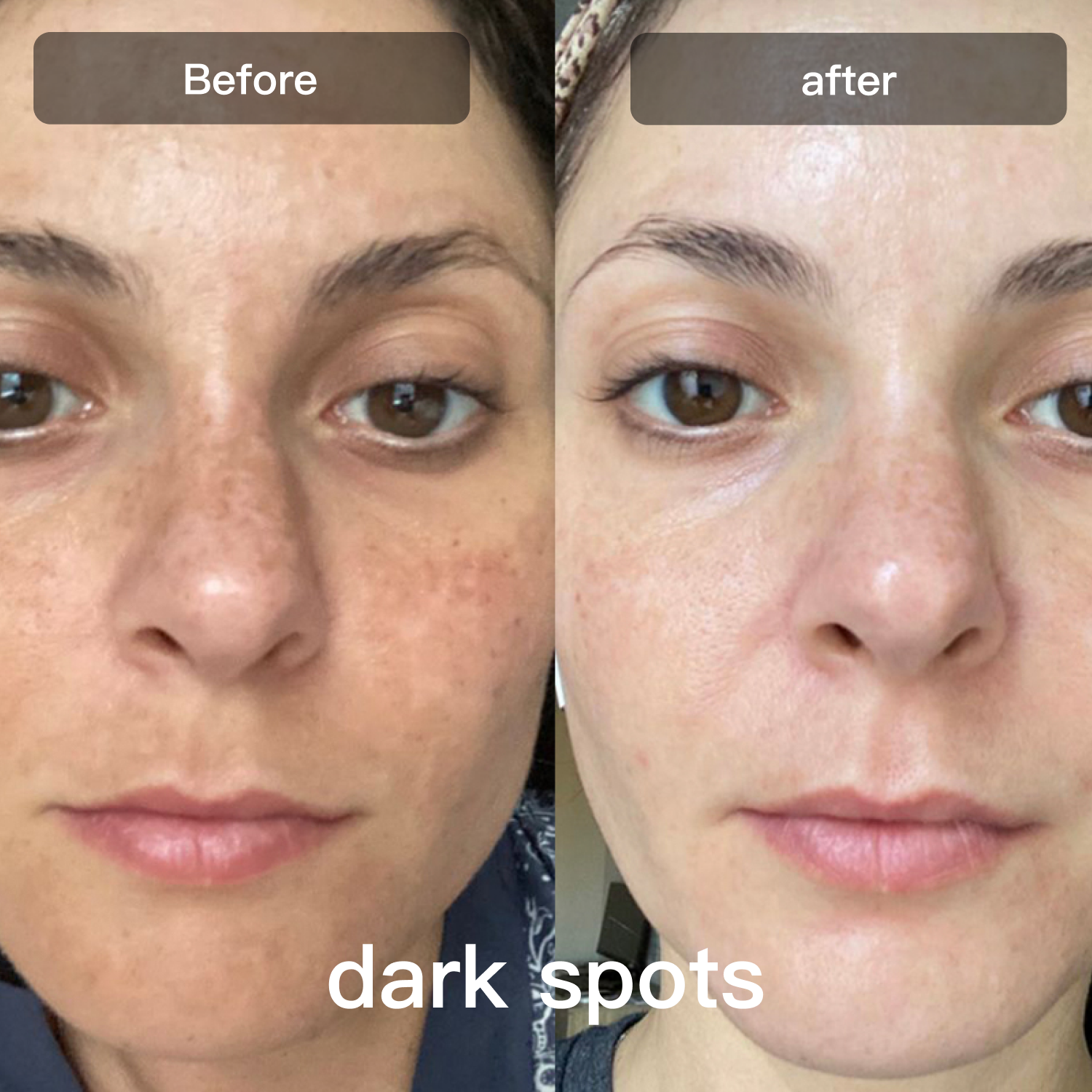 Seven-Wavelength LED Skin Therapy Device For Facial And Body Use